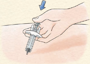 フィンガーグリップに指をかけたまま、プランジャーを完全に押し込みます