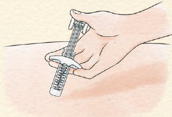 針がシリンジ内に引き込まれたことを確認し、注射部位からシリンジを離します