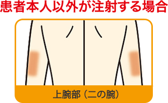 患者本人以外が注射する場合：上腕部